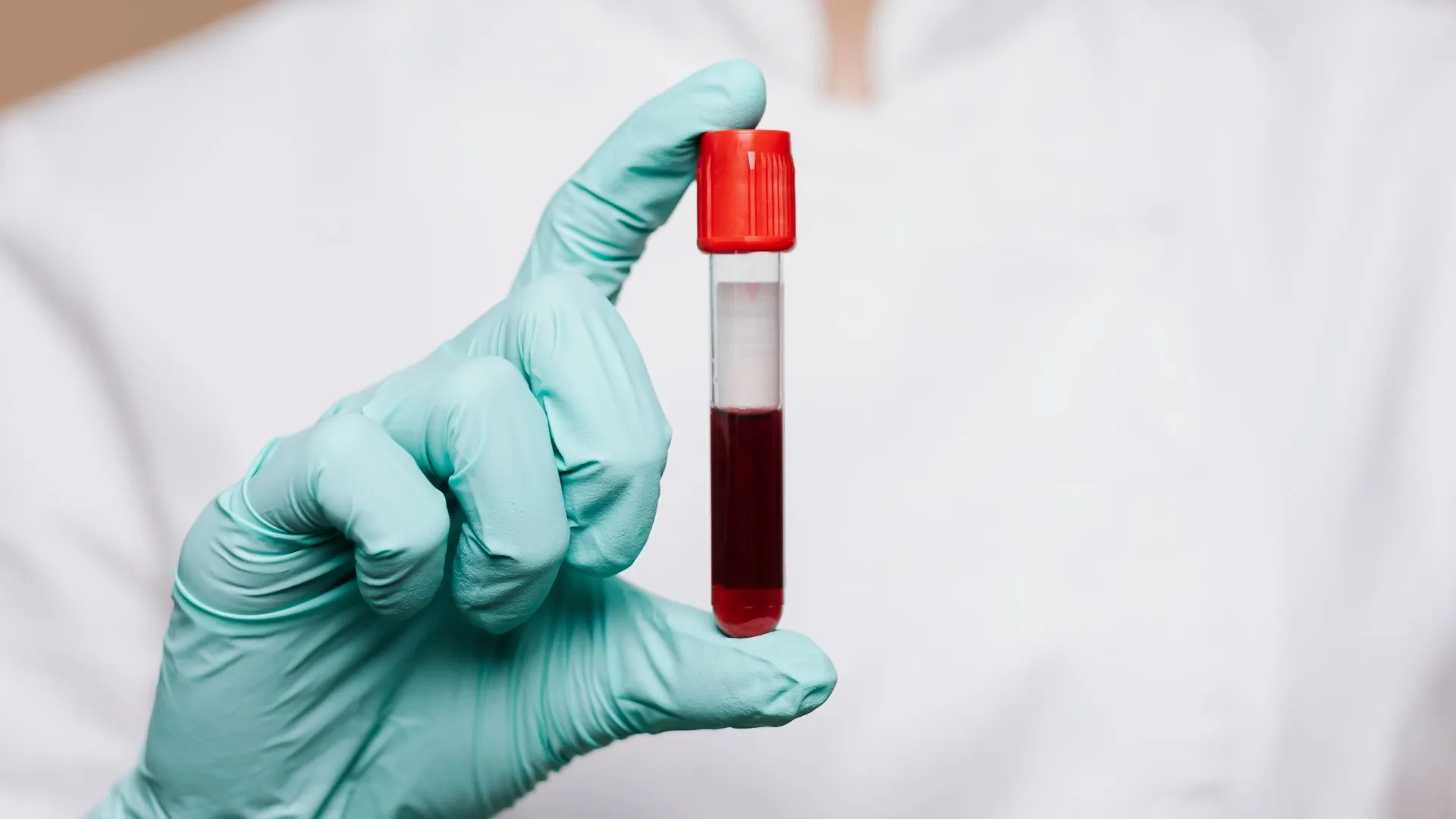 Anemia - przyczyny, objawy i leczenie