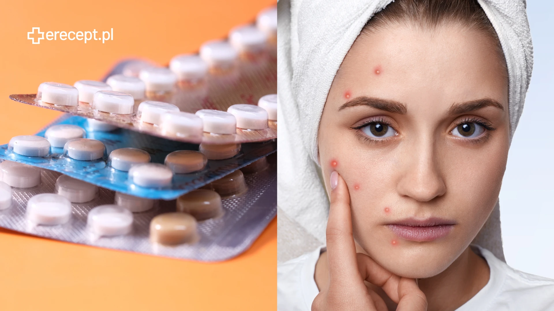 Antykoncepcja a problemy skórne - jakie są zalecenia dermatologów?