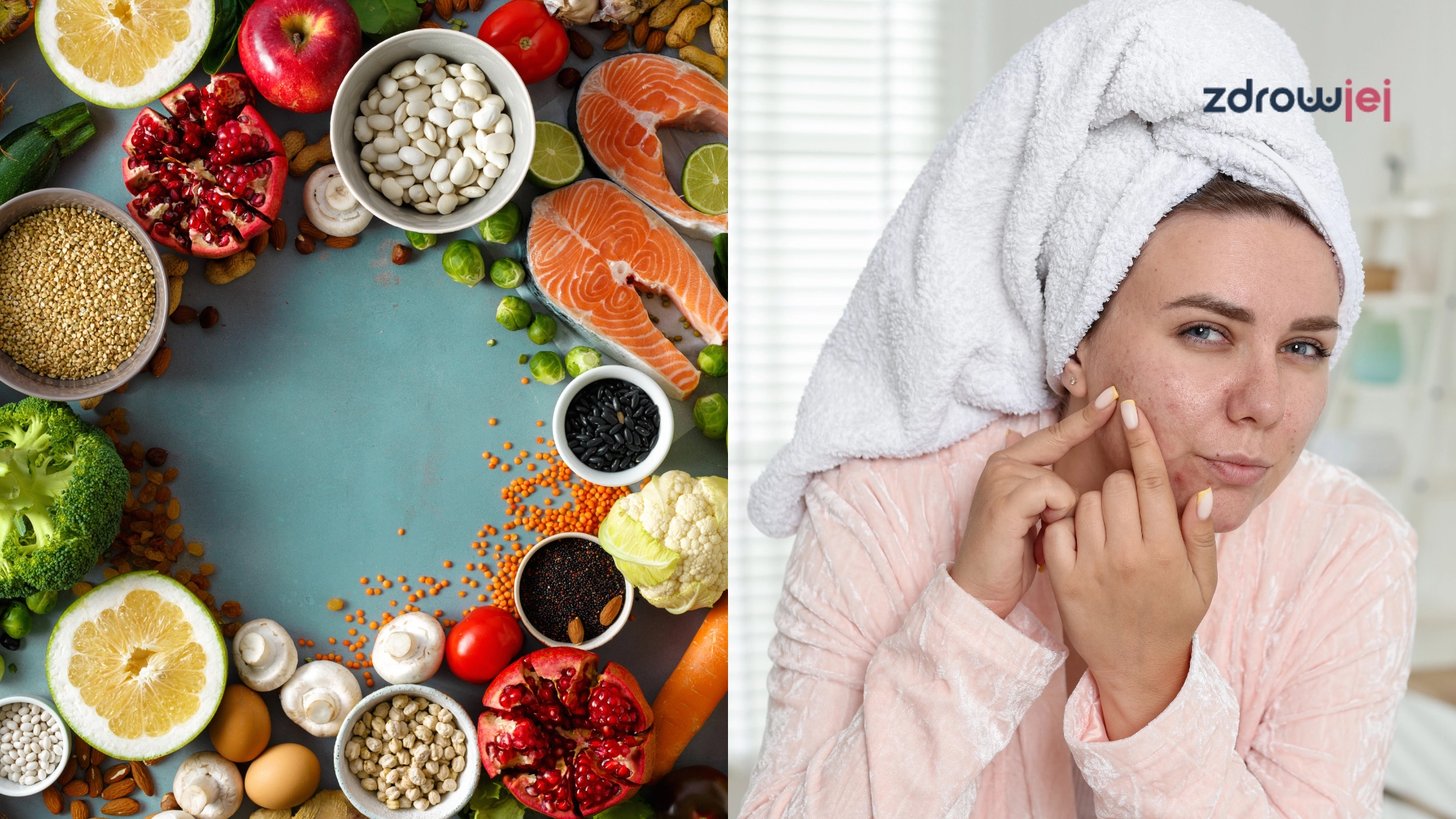 Trądzik hormonalny okiem dietetyka 